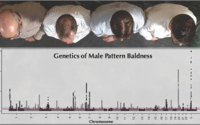 Genetics of Male Pattern Baldness