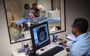 Doctors scan the brain of a newborn to detect a possible microcephalia caught through an Aedes aegypti mosquito bite, at the Obras Sociais Irma Dulce hospital in Salvador, Brazil.