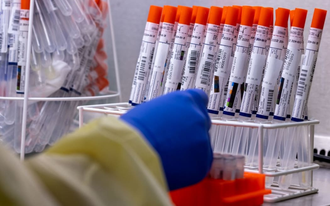 01 February 2022, Mecklenburg-Western Pomerania, Greifswald: Medical technical assistant Denise Dittmar pipettes swab samples from test centers and prepares them for further examination in the automated machine in the PCR laboratory