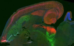 Cross section of a rat brain, showing showing intense expression of endocannabinoid receptors (red) - particularly in regions with dopamine producing neurons (green) and associated with movement.