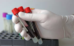 A scientist holds three test tubes filled with blood in a laboratory.