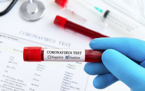 Coronavirus testing - doctor`s hand in medical glove holding test tube with Coronavirus positive blood over laboratory desk.