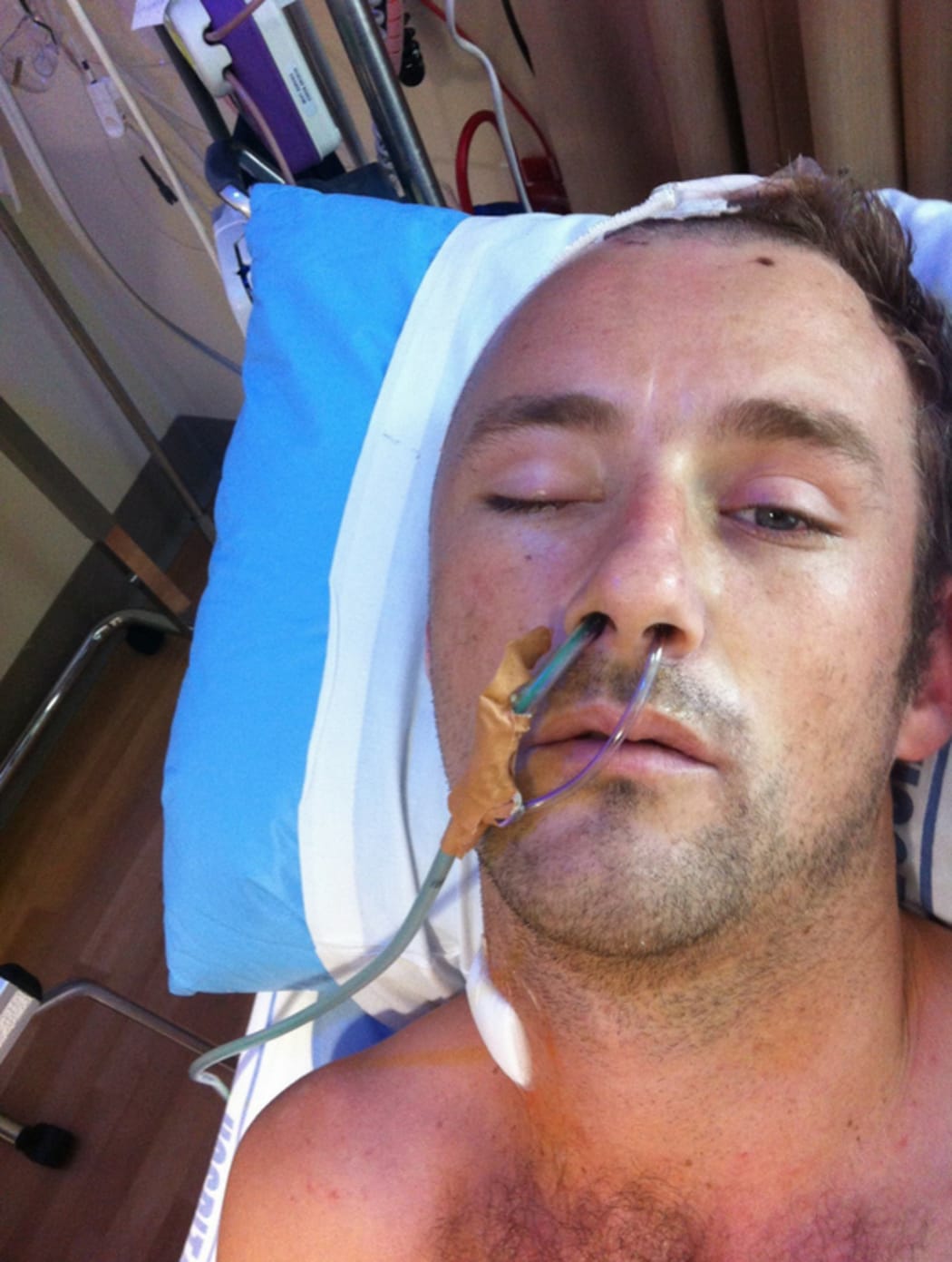 Benjamin Lightbody in hospital after the attack in Mt Eden prison in 2013.