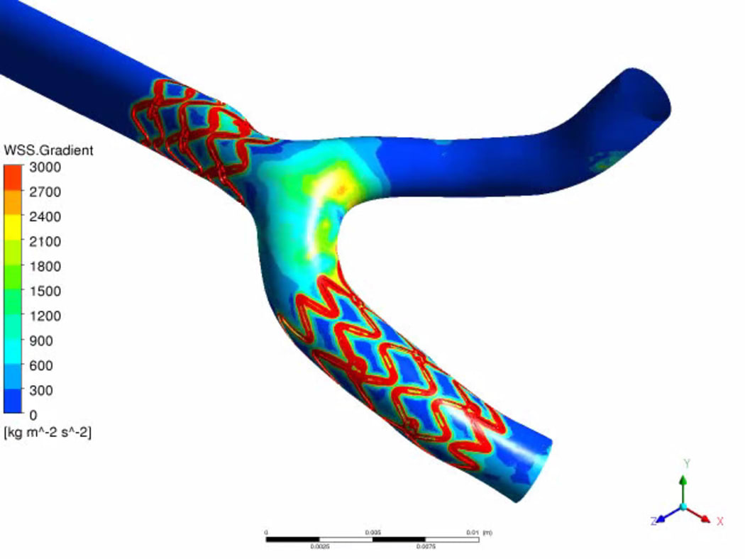 Computer models of blood flowing through a coronary artery.