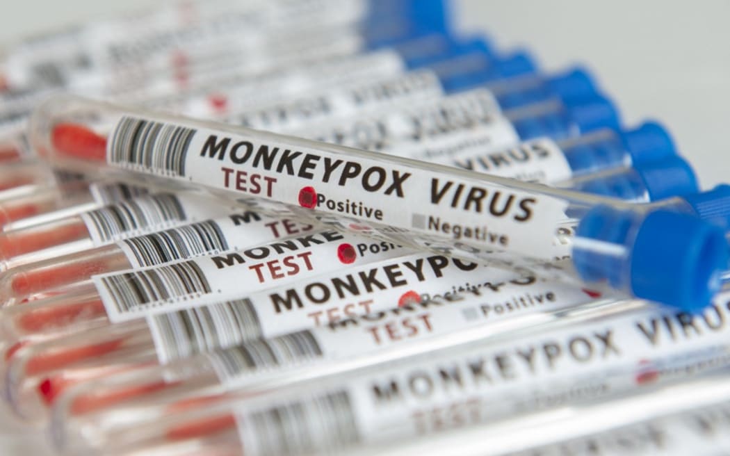 Illustration of test tubes labs labelled Monkeypox virus test.