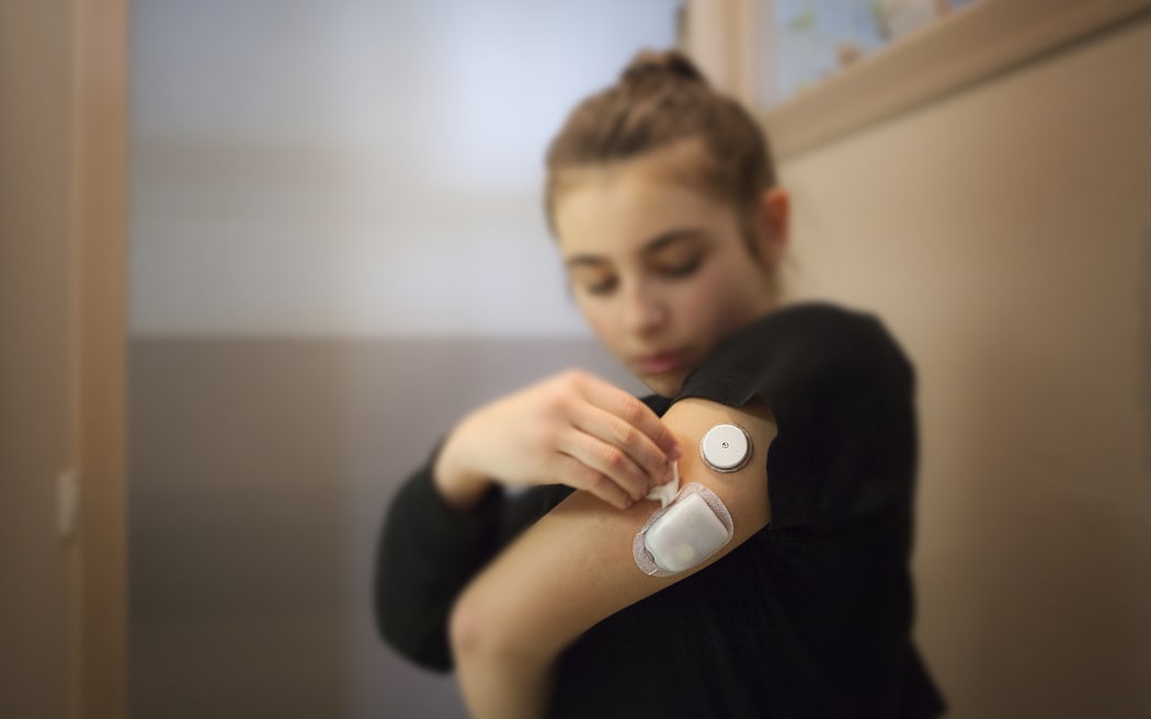 A teenager with type 1 diabetes uses a CGM - a continuous glucose monitoring device.