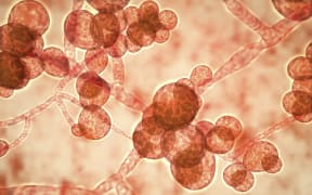 Candida auris, first identified in 2009, causes serious multidrug-resistant infections in hospital patients and has high mortality rates. It causes bloodstream, wound and ear infections and has also been isolated from respiratory and urine specimens.