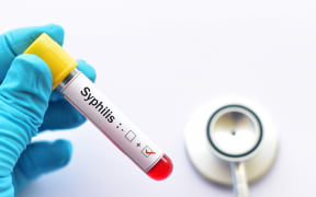 Blood sample positive with syphilis