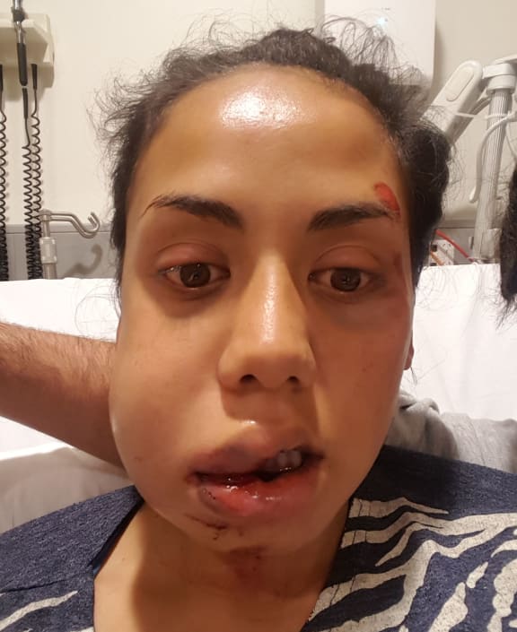 Raven Torea was assaulted while walking on the beach in Waiheke Island