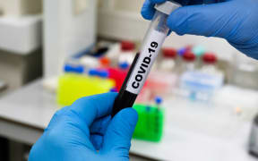 Blood test for COVID-19. Examination of a blood sample for the presence of SARS-CoV-2 coronavirus.