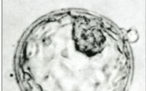embryo cells