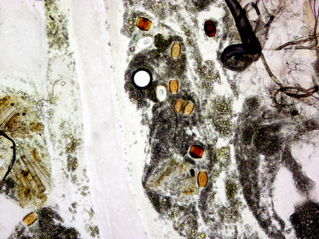 A microscope image of some cysts inside an insect host. You can see different cells and tissues of the insect, as well as the cysts which look like small orange pellets with a translucent centre.