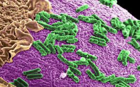 Microbial environment inside the human gut.