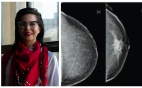 Dr Monica Saini believes New Zealand women should be given more information about the density of their breasts when they get a mammogram.
