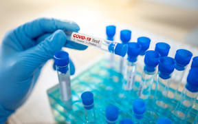 Medical scientist hand with blue sterile rubber gloves holding COVID-19 test tube in hospital laboratory. Male doctor or physician getting result of Coronavirus case.