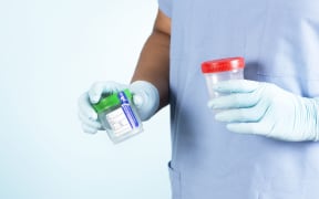 Urine cup drug test drug testing