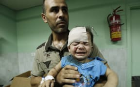 A child wounded after the UN building was shelled is treated in hospital.
