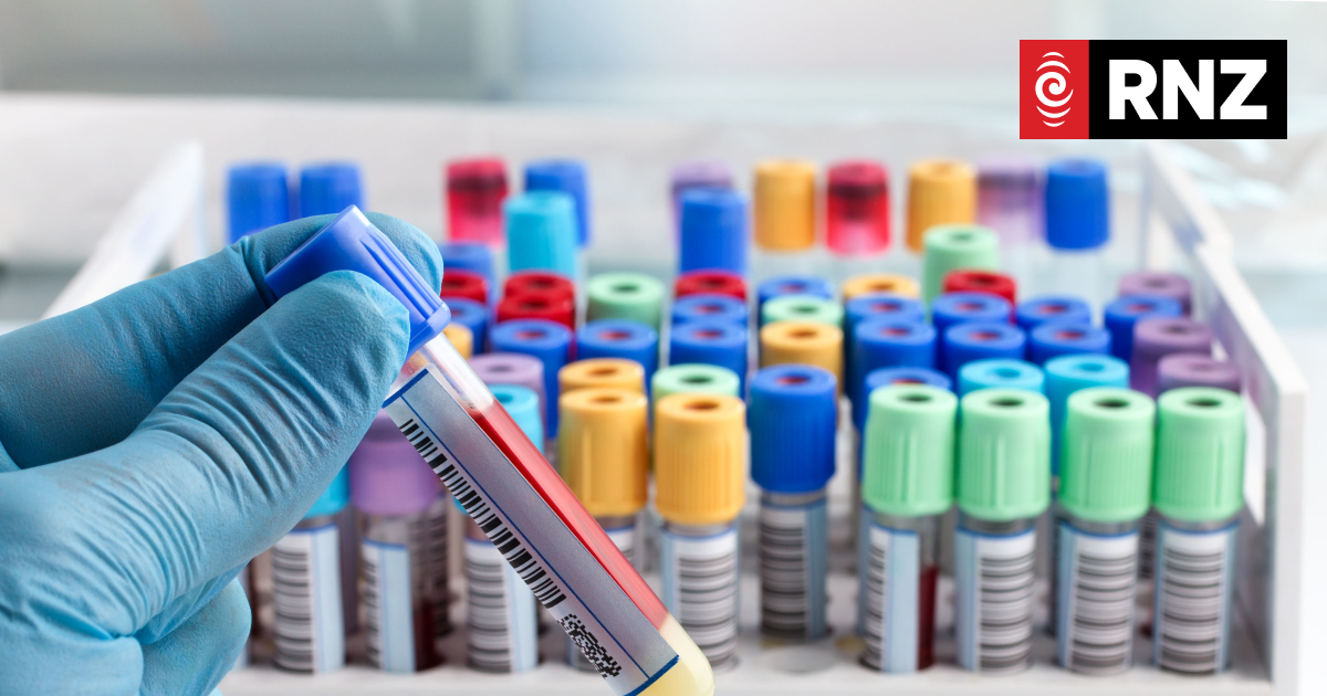 Lab tests group plans to cut Nelson services, courier samples to Christchurch - Vimarsana News