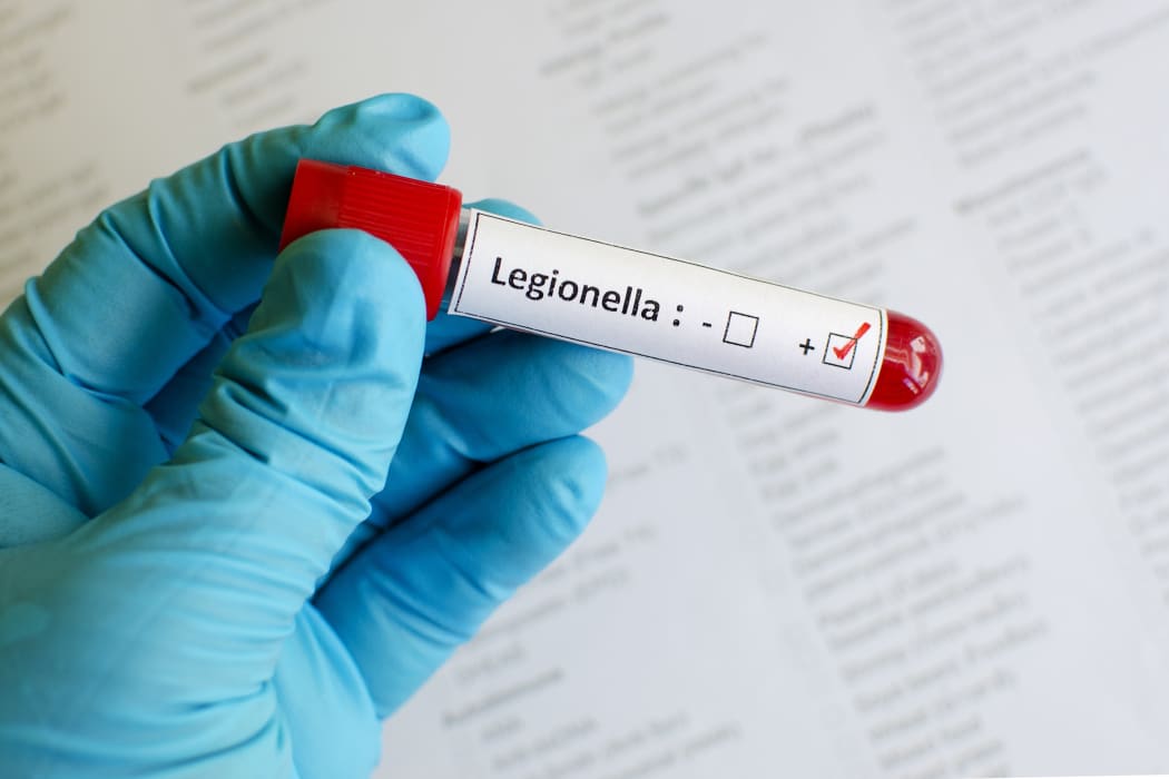 Legionnaires' disease study prompts call for mandatory water tests across NZ RNZ News