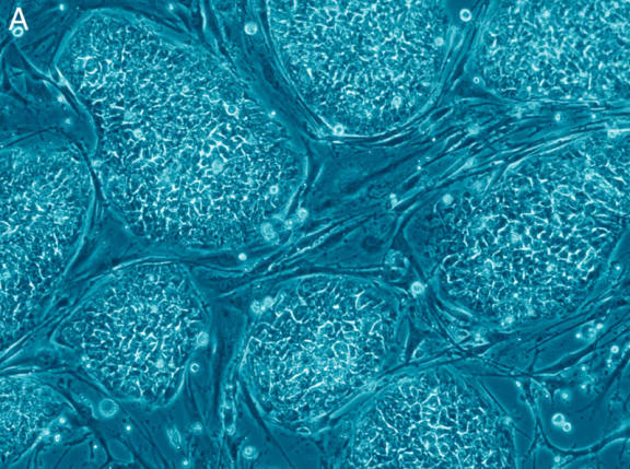 Human embryonic stem cells