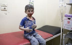 A Syrian boy awaits treatment at a make-shift hospital following air strikes on rebel-held eastern areas of Aleppo.