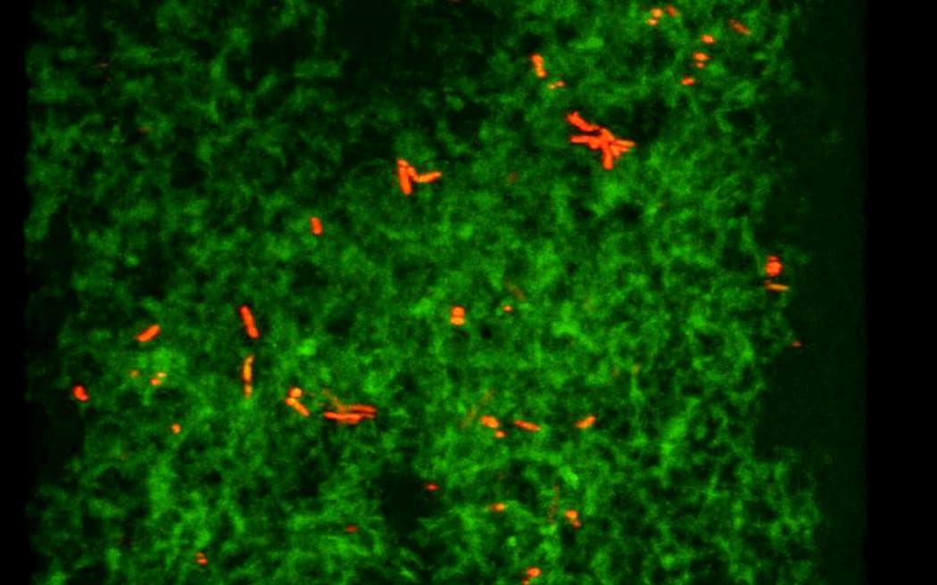 Salmonella bacteria (red) entrapped in a amyloid matrix (green) at an early stage of infection.