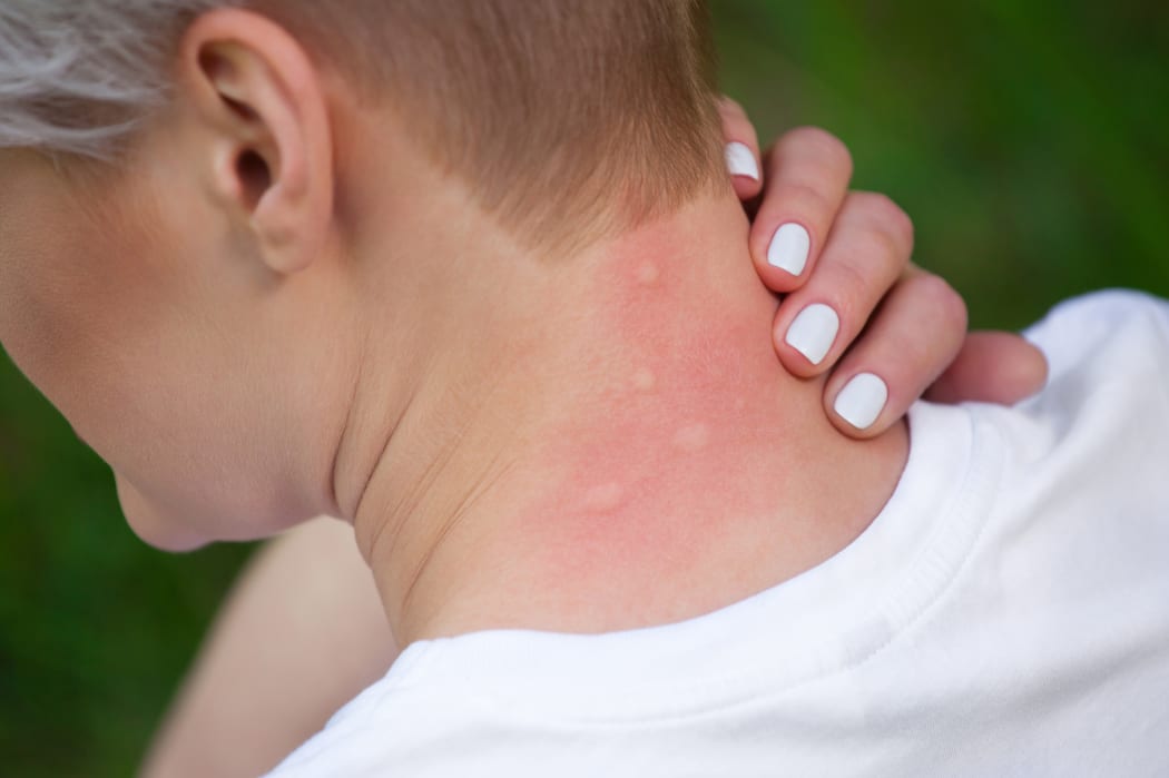Girl with blond hair, sitting with his back turned and scratching bitten, red, swollen neck skin from mosquito bites in the summer in the forest.  Close-up up of visible insect bites. Irritated skin.