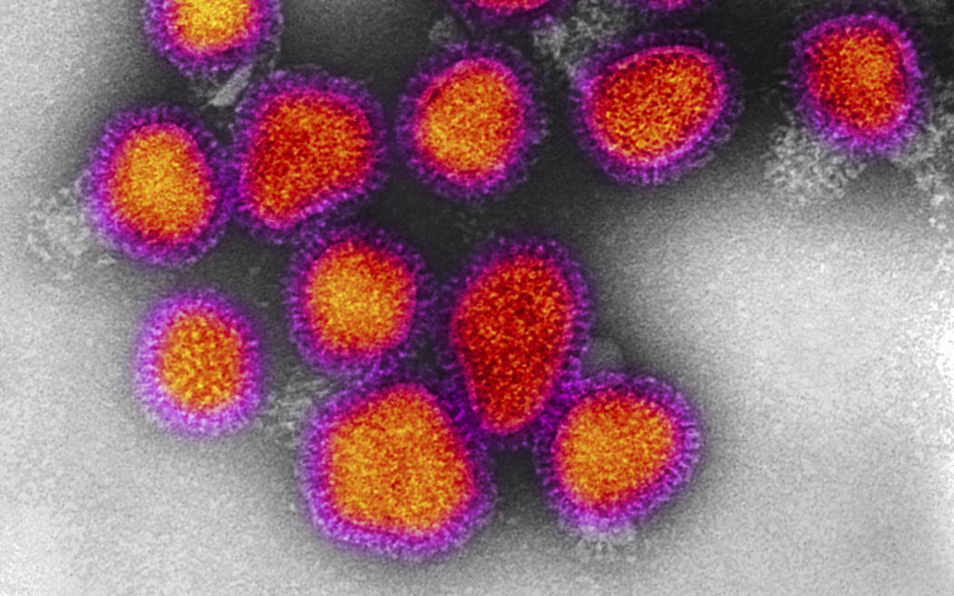 Research for flu vaccines cannot keep up with the speed at which new strands, such as H3N2, of the virus develop.