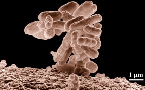 A cluster of Escherichia coli bacteria magnified 10,000 times