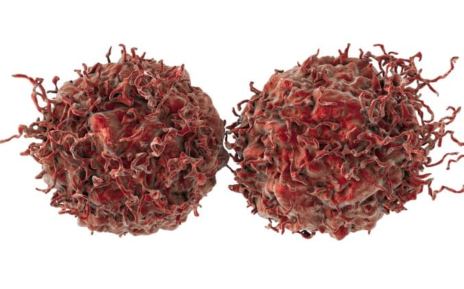 Prostate cancer cells (illustration)