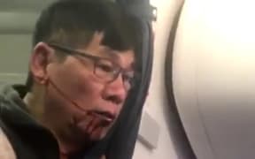 The man is pictured bleeding from the mouth after he was dragged off the overbooked United Airlines flight.