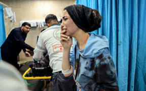 An injured Palestinian woman reacts as she stands in the emergency room of the Al-Aqsa Hospital following an Israeli bombardment in Deir el-Balah, in the central Gaza Strip on 15 November, 2023.