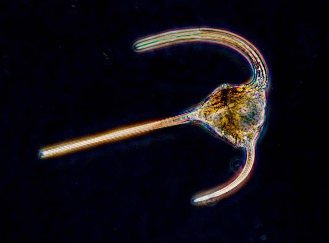Algae similar to this magnified dinoflagellate could be the source of a powerful local anesthetic.