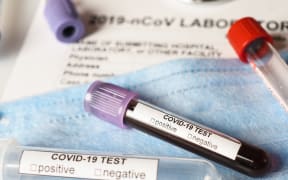 Coronavirus COVID-2019 test concept with blood test tubes, test form and other medical objects
