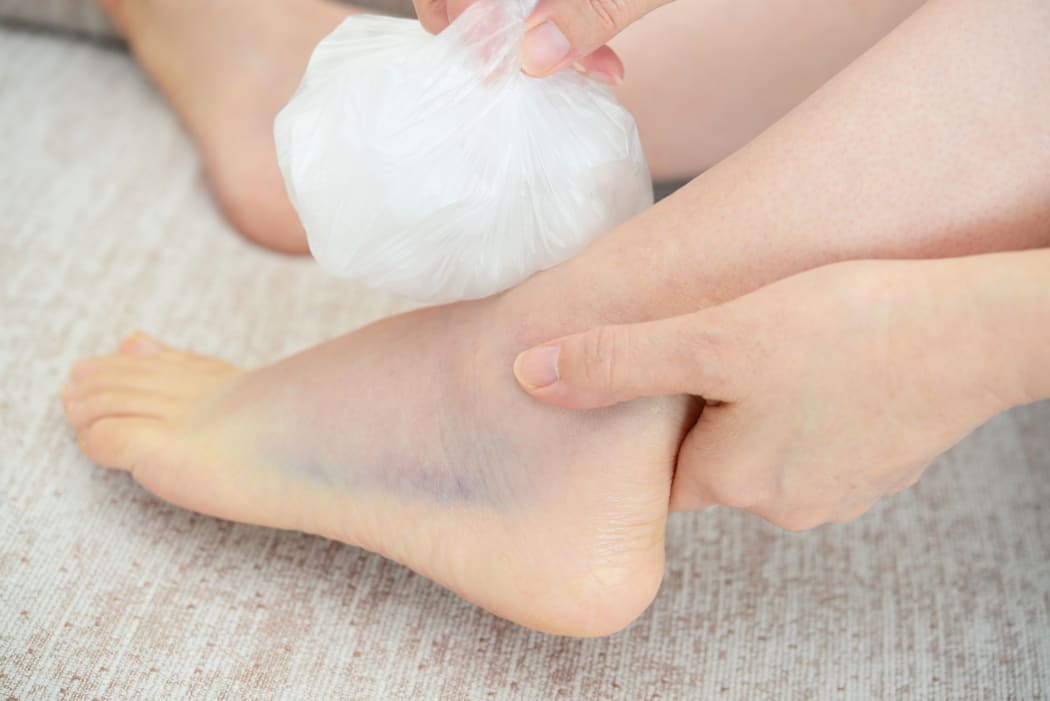 Sprained your ankle? DON'T ice it! RNZ