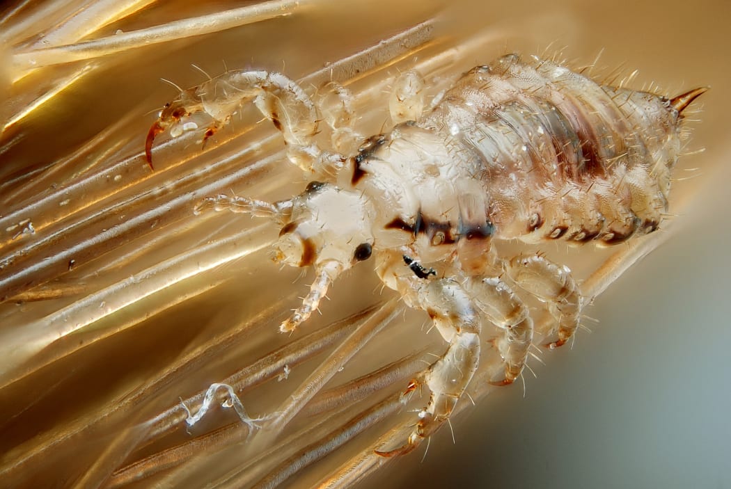 Everything you need to know about Headlice | RNZ