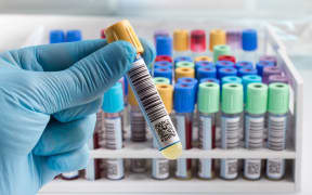 A lab technician holding blood tube test.