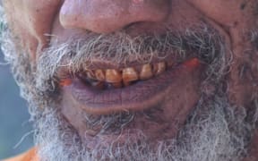 Betelnut-stained mouth, Papua New Guinea.
