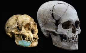 Hominid Mandibulas overlayed over LB1 Hobbit skull (left), next to modern human skull