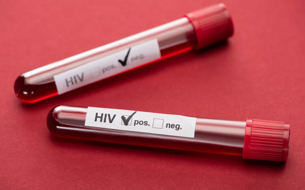 selective focus of negative and positive hiv blood sample test on red background
