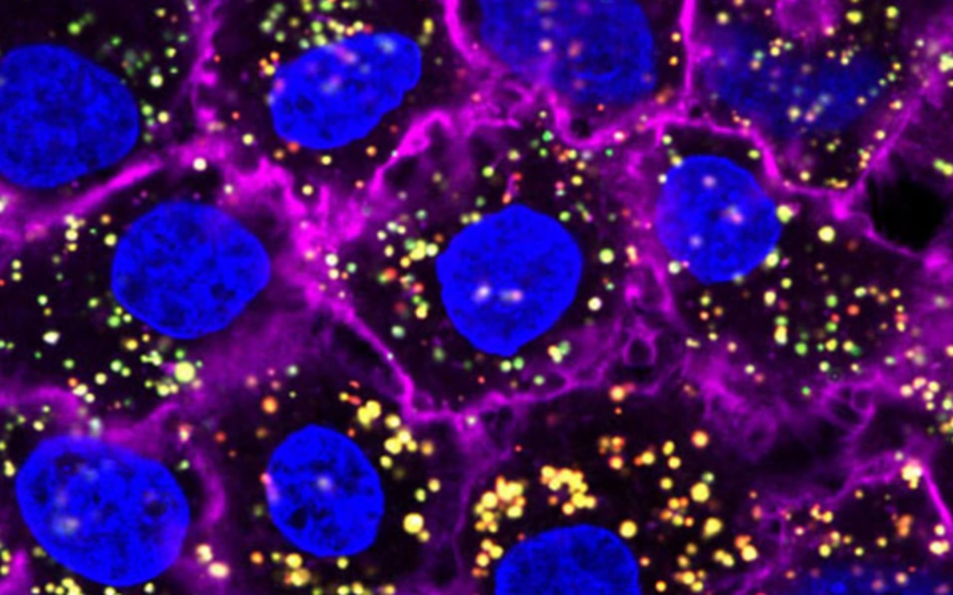 Nanoparticles (yellow) targeting and entering cancer cells (blue