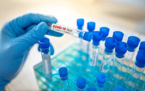 Medical scientist hand with blue sterile rubber gloves holding COVID-19 test tube in hospital laboratory.