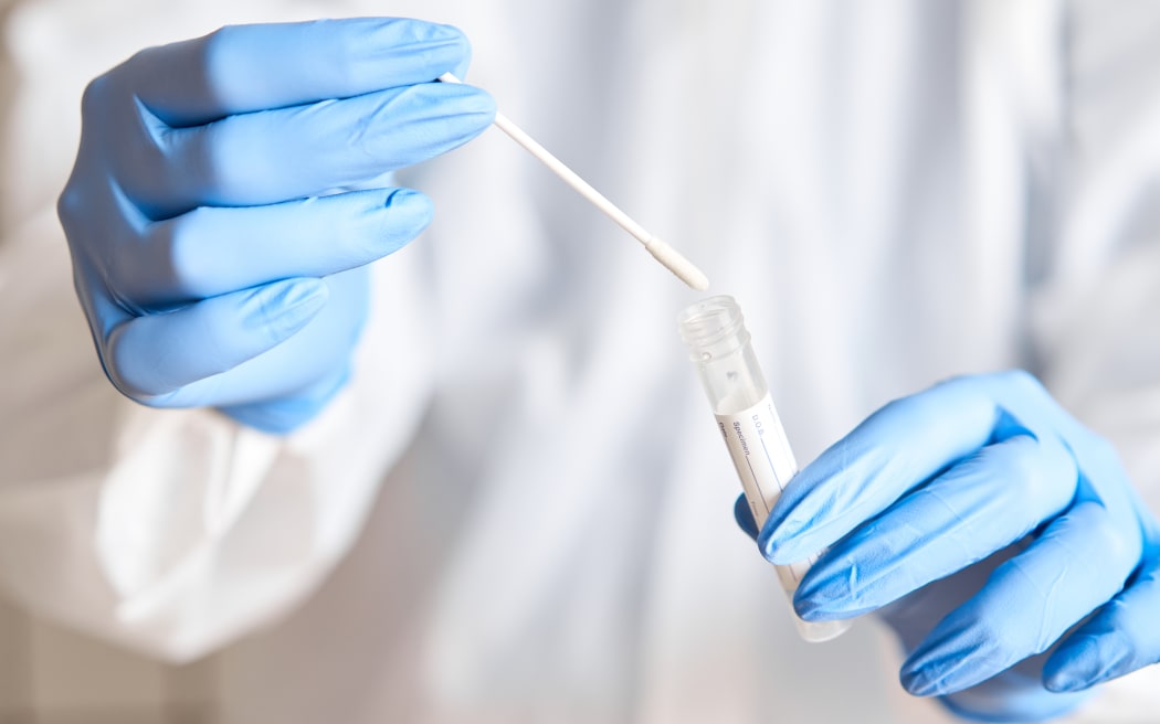 Médico sosteniendo un tubo de ensayo con hisopo para el análisis de 2019-nCoV. Prueba de coronavirus. Guantes médicos azules y mascarilla protectora para protección contra el virus covid-19. Coronavirus y pandemia
