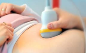 A pregnant woman goes through an ultrasound.