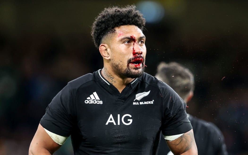 新西蘭選手阿迪·薩維亞（Ardie Savea）因血液受傷