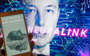 Musk's Neuralink faces federal probe, employee backlash over animal tests