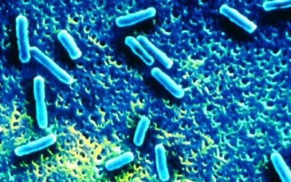 A coloured scanning electron micrograph (SEM) of a group of Yersinia pseudotuberculosis bacteria.