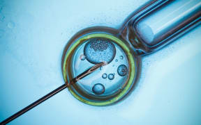 A macro photo showing in vitro fertilisation.