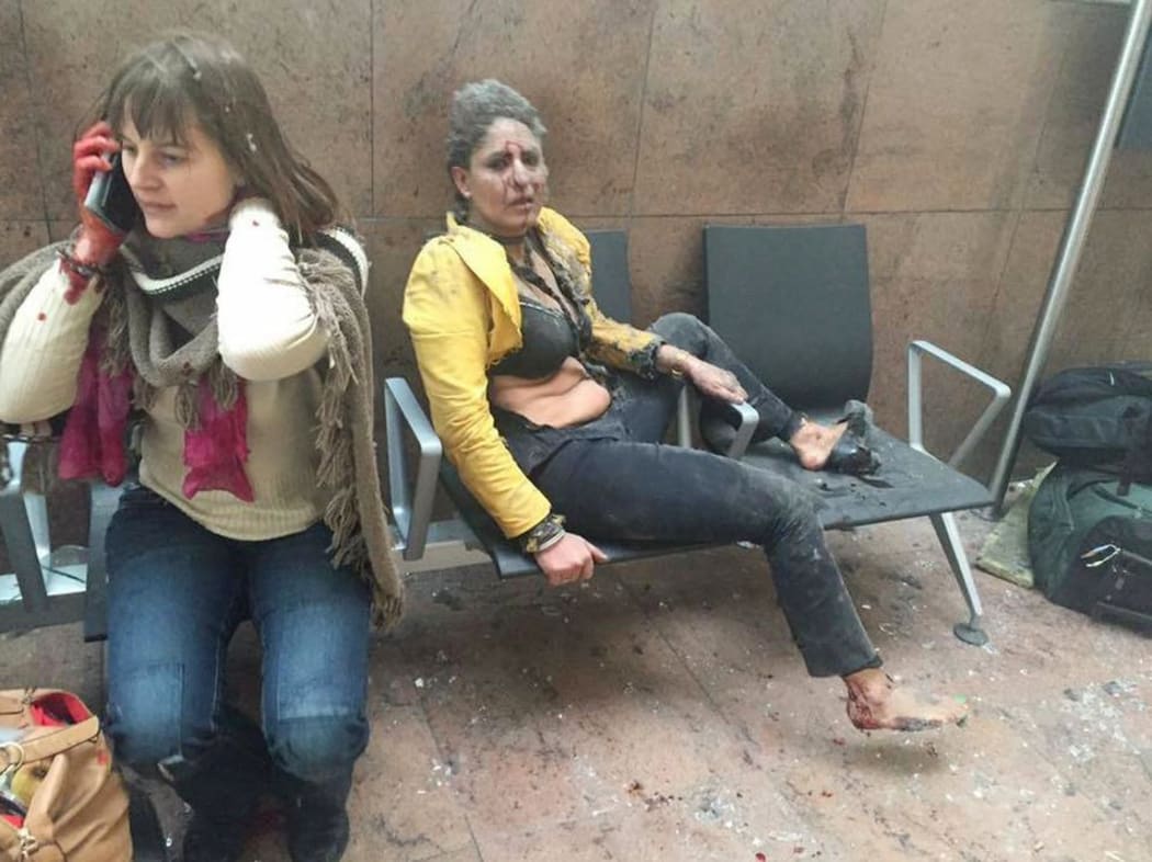 An injured woman at Zaventem airport following the explosions.