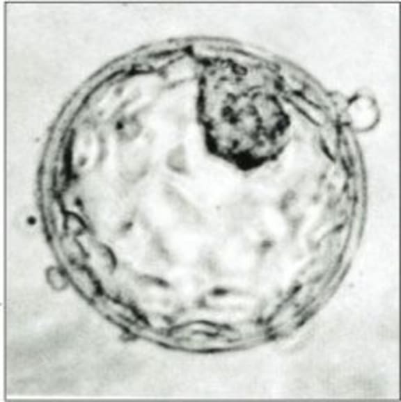 By about seven days after fertilisation, a human embryo reaches the blastocyst stage.